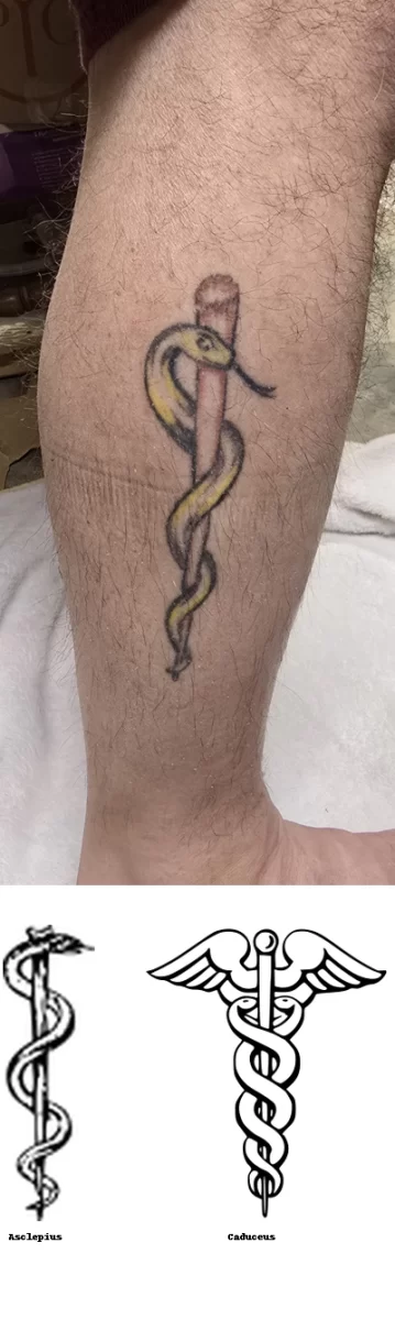 Side-by-side comparison showing a tattoo of the Staff of Asclepius on a person's leg above a labeled graphic of two medical symbols: the Staff of Asclepius with a single snake on the left, and the Caduceus with two snakes and wings on the right. The image emphasizes the difference between the historically accurate medical symbol and the commonly mistaken one.